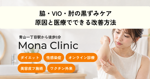 脇・VIO・肘の黒ずみケア|原因と医療でできる改善方法