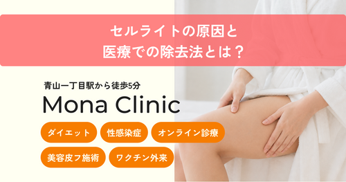 セルライトの原因と医療での除去法とは？