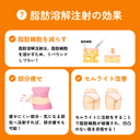 脂肪溶解注射(カベリン)